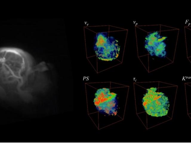 Imaging tumor cellular and vascular properties
