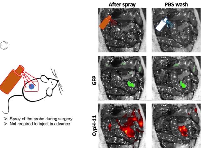 Instantaneous tumor spray for real-time surgical guidance