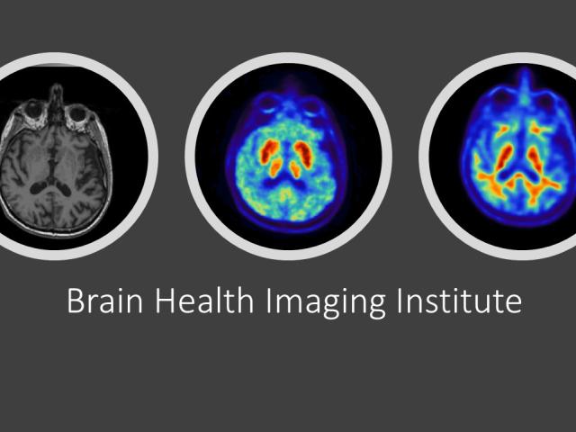Three brain images