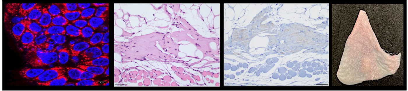 Confocal microscopy of ultrasmall Cornell Prime Dot internalization