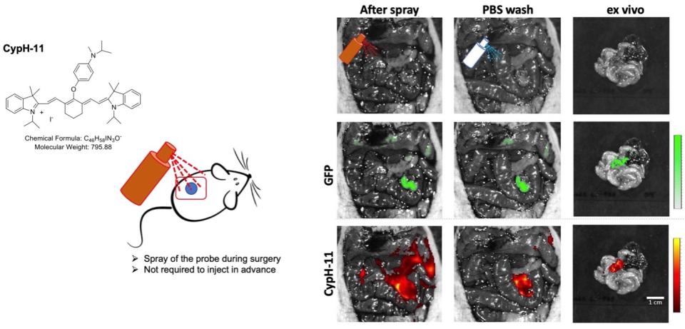 Instantaneous tumor spray for real-time surgical guidance