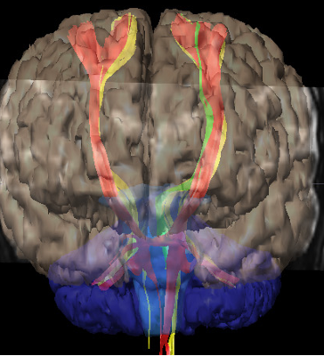 Neuroradiology Brain Radiology Key