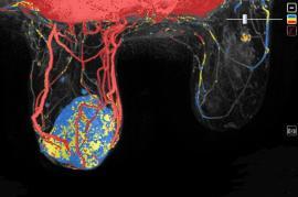 Breast Imaging | Department of Radiology