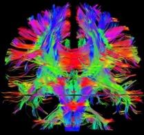 Weill Cornell Medicine Neuroradiology Fellowship