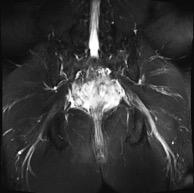 Weill Cornell Medicine Neuroradiology Fellowship