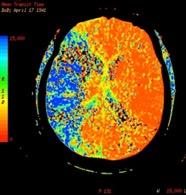 Weill Cornell Medicine Neuroradiology Fellowship