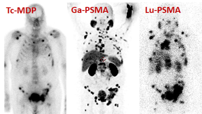 pet-ct