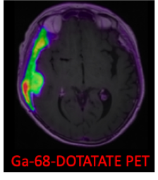 pet-ct