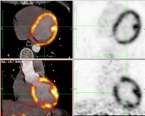 pet-ct