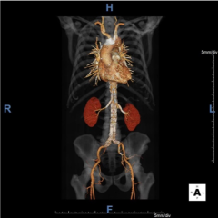 abdominal_imaging